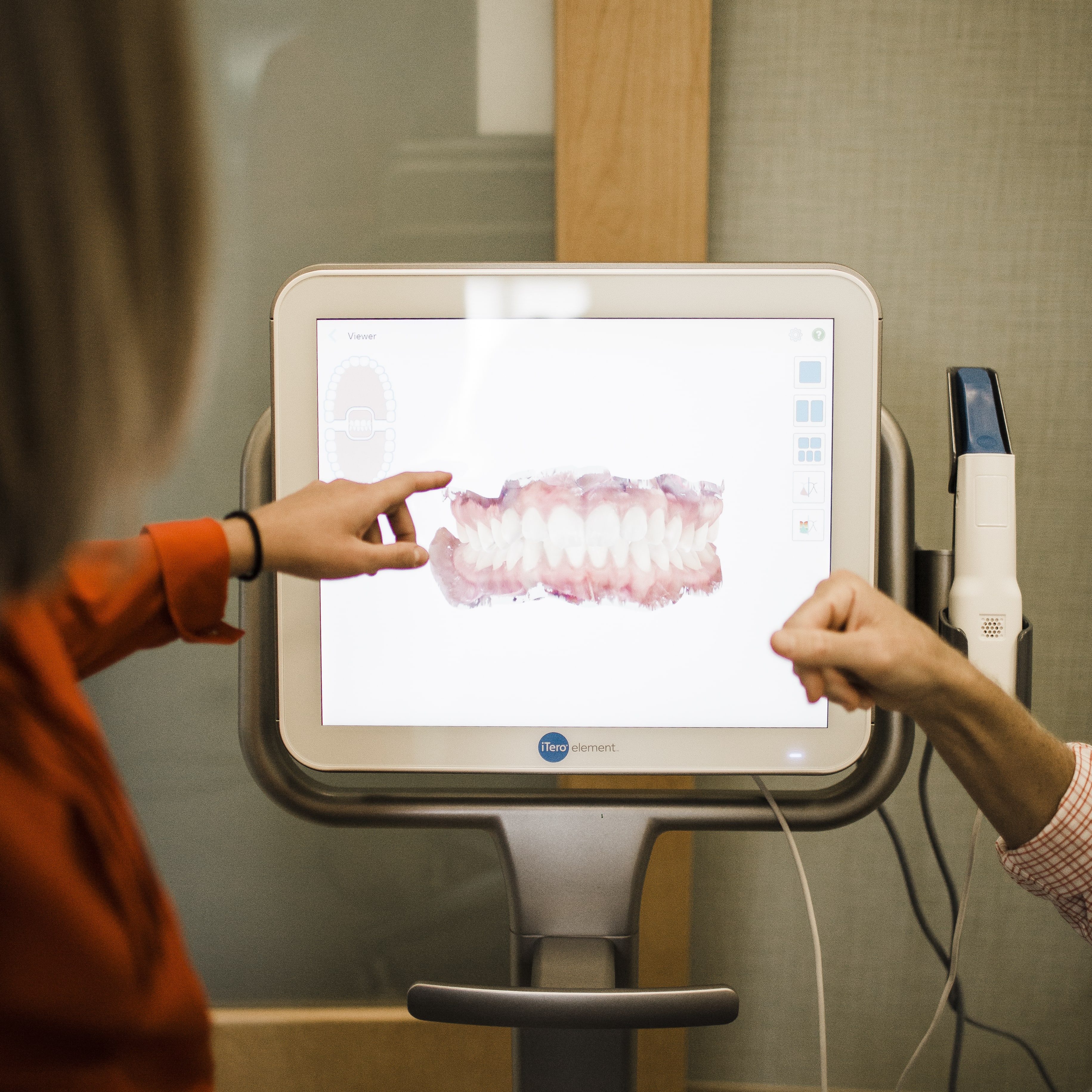 The iTero screen with a 3D image of patients mouth
