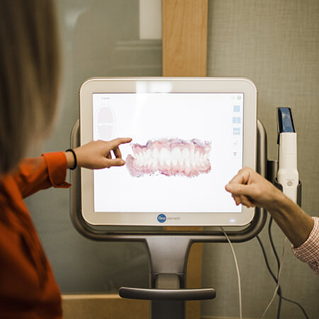 The iTero screen with a 3D image of patients mouth to show that our Orthodontists in Brentwood, TN use state-of-the-art technology.